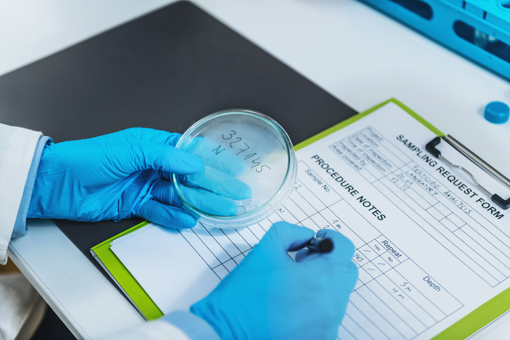 quality-assessment-in-microbiology-laboratory-2021-08-28-17-41-50-utc.jpg